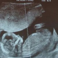  Niño o niña?? Ayudadme expertas🔮 - 1