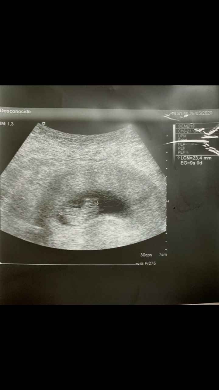Ayuda con método ramzi: niño o niña? 6