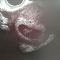 7 semanas y 4 días