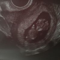 10 semanas
