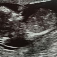 13 semanas