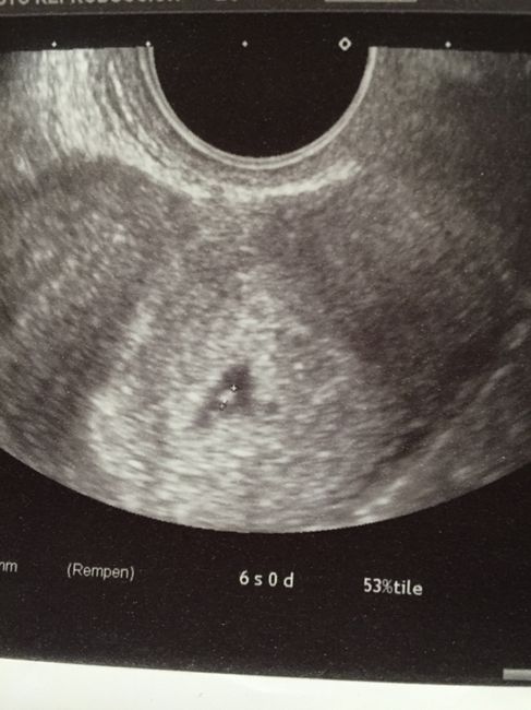 Futuras mamis octubre 2016 - 1