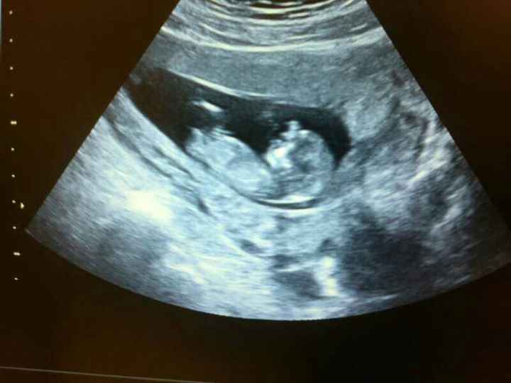 12 semanas