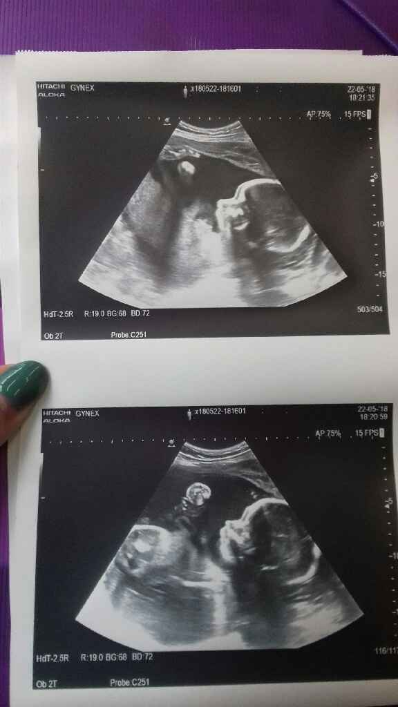 Nuevo! Futuras mamas Septiembre 2018 - 1