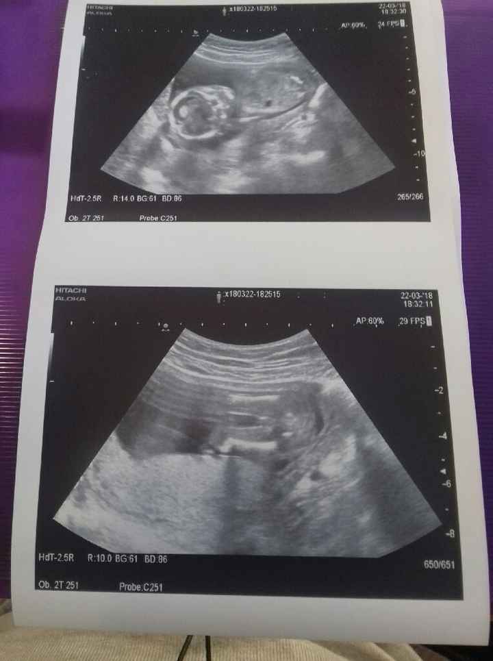 Nuevo! Futuras mamas Septiembre 2018 - 1