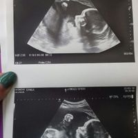 Nuevo! Futuras mamas Septiembre 2018 - 1