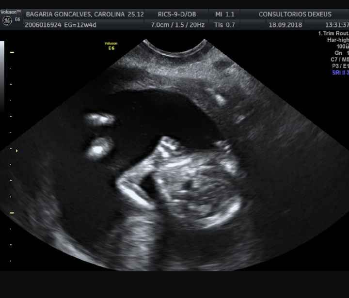 Futuras mamás marzo 2019 - 1