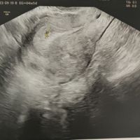 Futuras mamás Mayo 2024 - 1