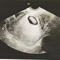 Futuras mamás Mayo 2024 - 1