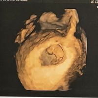 Futuras mamás Mayo 2024 - 2