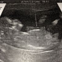 Nuevo! Futuras mamas Septiembre 2018 - 1