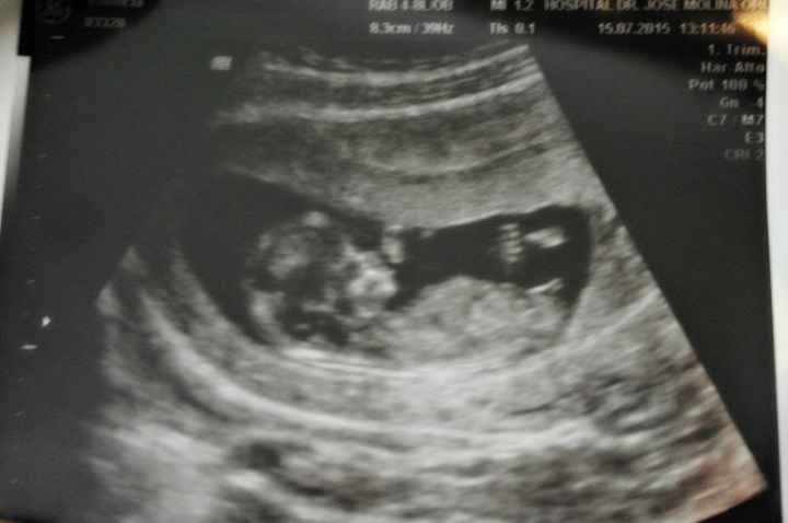 nuestro futuro hijo/a