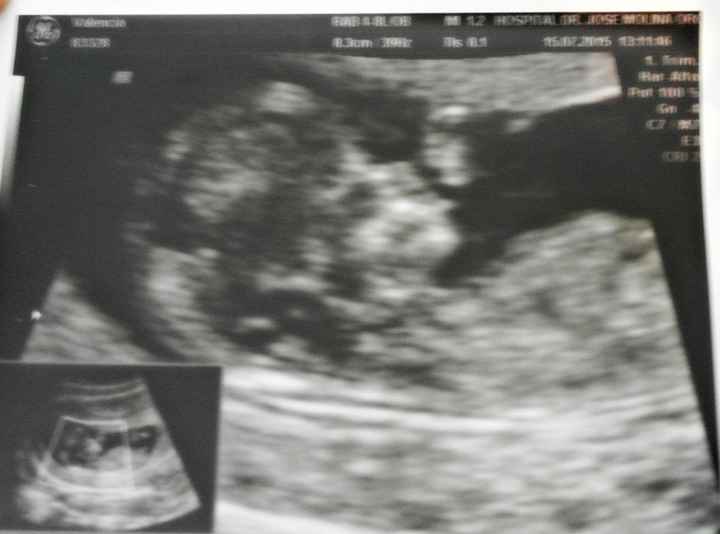 nuestro futuro hijo/a
