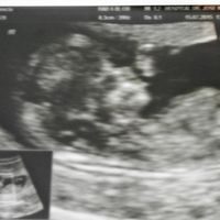 nuestro futuro hijo/a