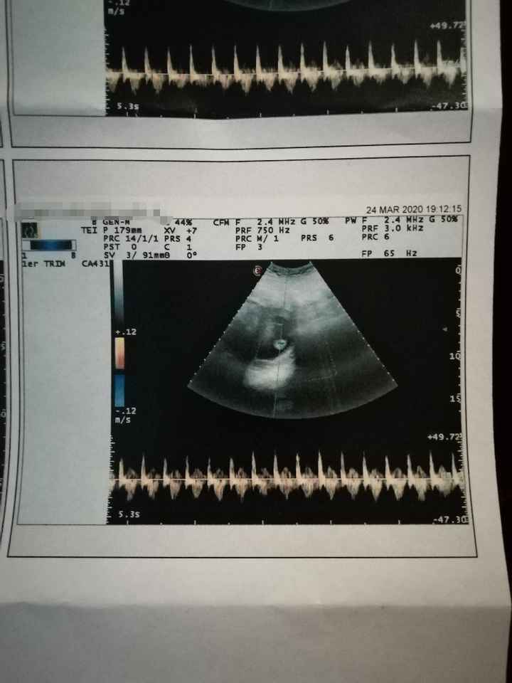 Futuras mamas octubre 2020 - 1