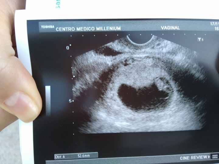 Mamis julio 2017 - 1