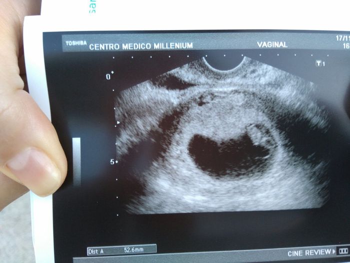 Mamis julio 2017 - 1