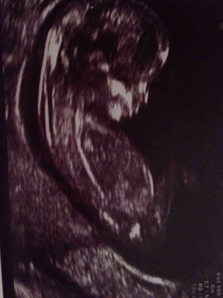 Futuras mamas septiembre 2016 - 1