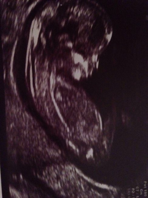 Futuras mamas septiembre 2016 - 1