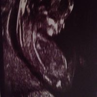 Futuras mamas septiembre 2016 - 1