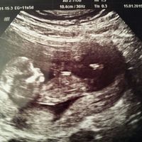 El consultorio de Lita para futuras mamis - 1