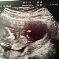 El consultorio de Lita para futuras mamis - 2
