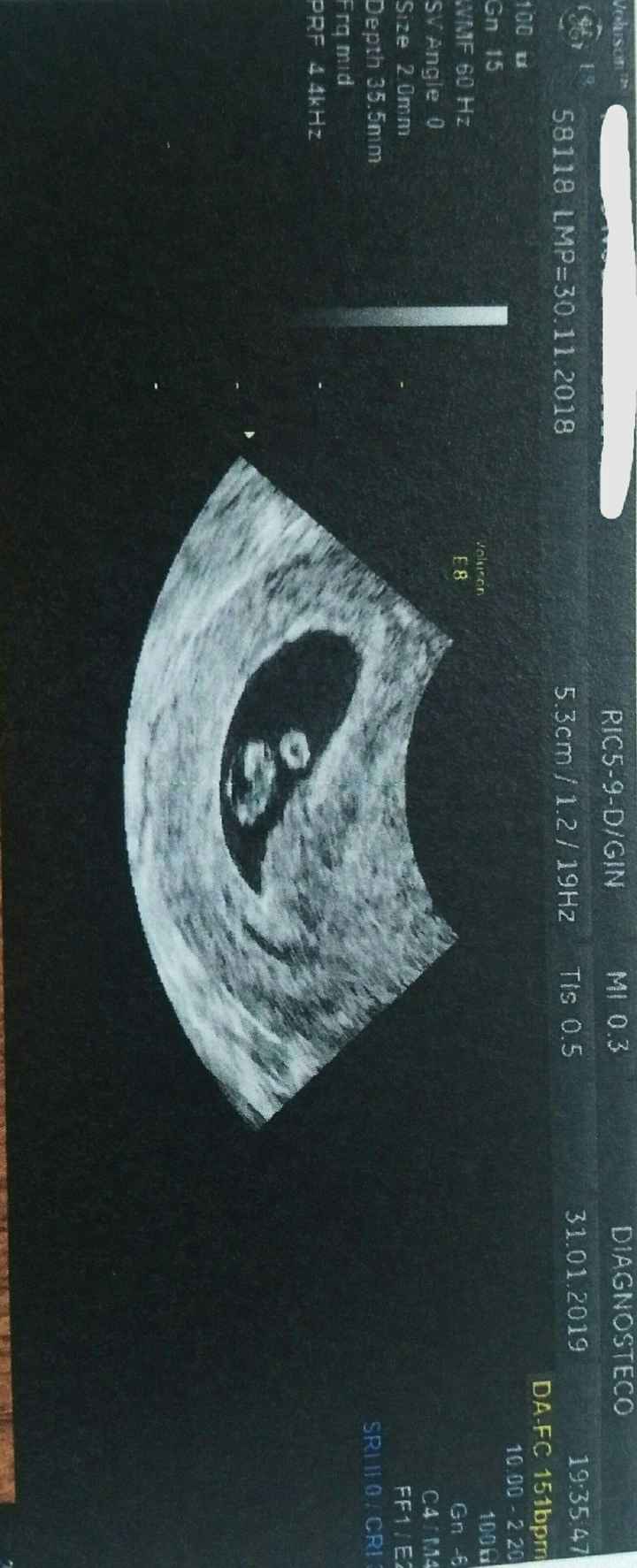 Esta es otra foto mismo embrion