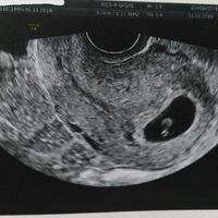 Tercera foto