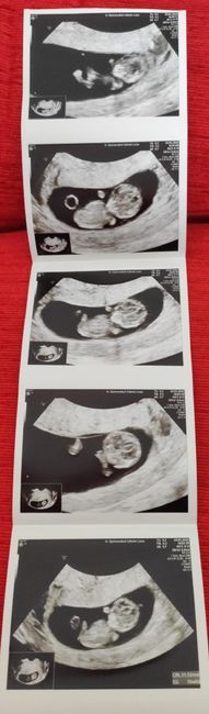Futuras mamas Diciembre 2020 - 1