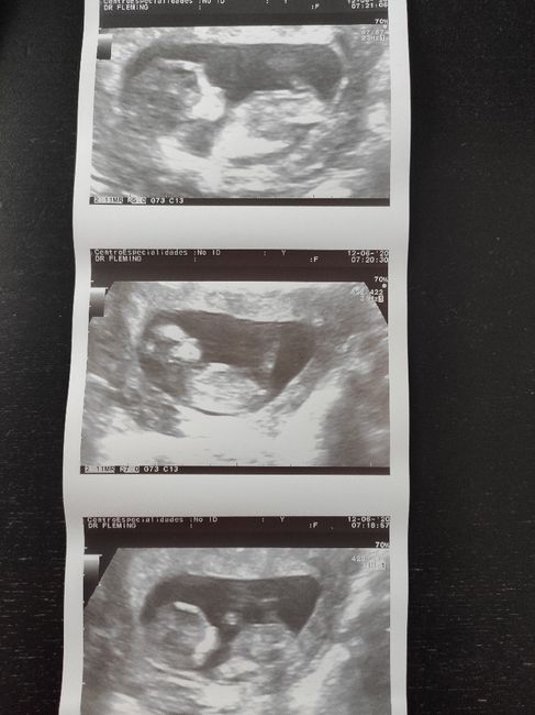 Futuras mamas Diciembre 2020 - 1