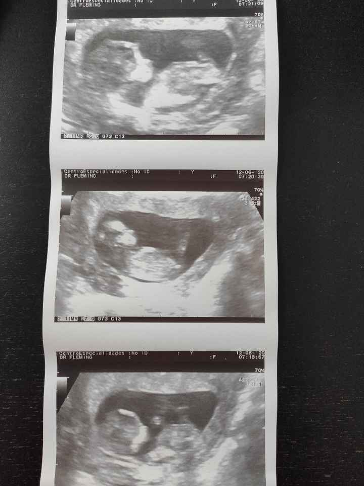 Futuras mamas Diciembre 2020 - 1