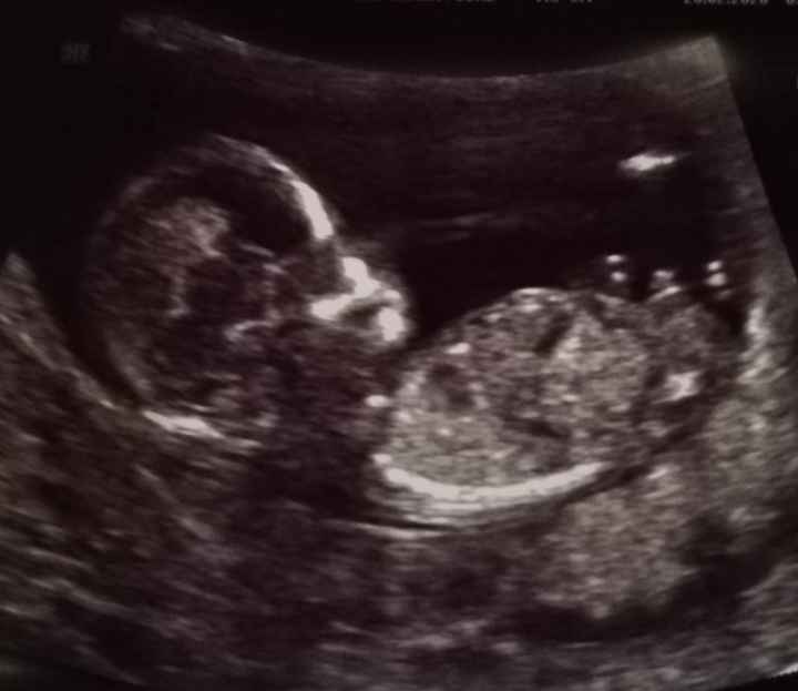 Futuras mamás Septiembre 2020 - 1