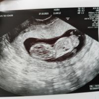 Niño o niña - 1