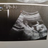 Niño o niña - 1