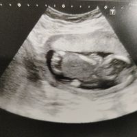 Niño o niña - 1