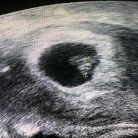 mamis febrero 2020 - 1