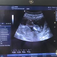 Niño o niña - 1