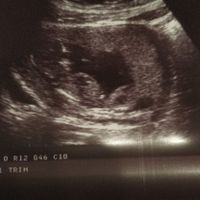 Futuras mamás octubre 2021 - 1