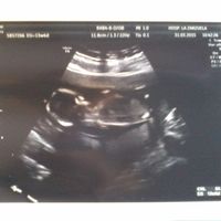 14semanas