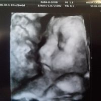 4d 27semanas