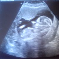 mi bebé de 12+5