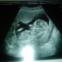 mi baby 12+5
