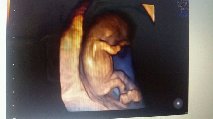 Mamis abril 2016 - 1