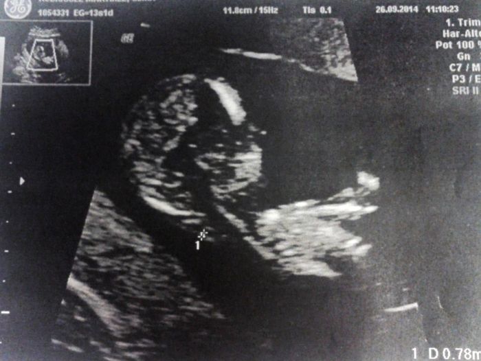 Mi bollito 13 2