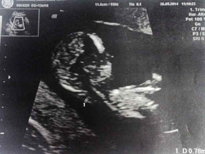 Mi bollito 13 2