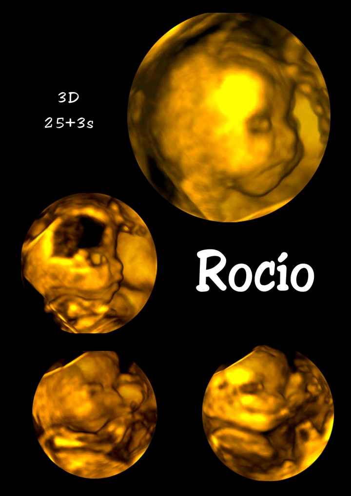 Rocio 3D 25+3