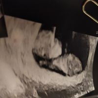Futuras mamas Diciembre 2020 - 1