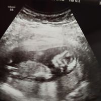 Futuras mamas Diciembre 2020 - 1