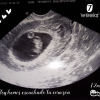  Futuras mamás agosto 2018 - 1