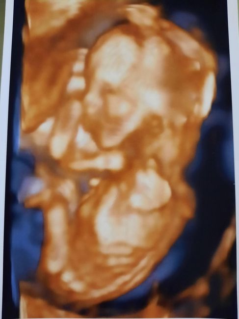 Futuras mamás julio 2021🤰🌹😍😍 - 2